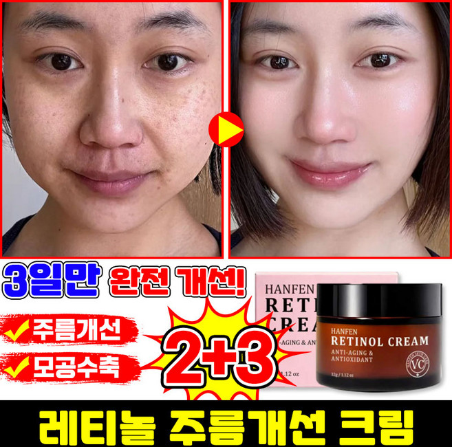 [100% 효과있음] 레티놀 크림 모공수축 크림 주름개선 재생크림 탄력 리프팅 미백 크림 미간 팔자주름 링클케어 수분크림, 5개, 32g
