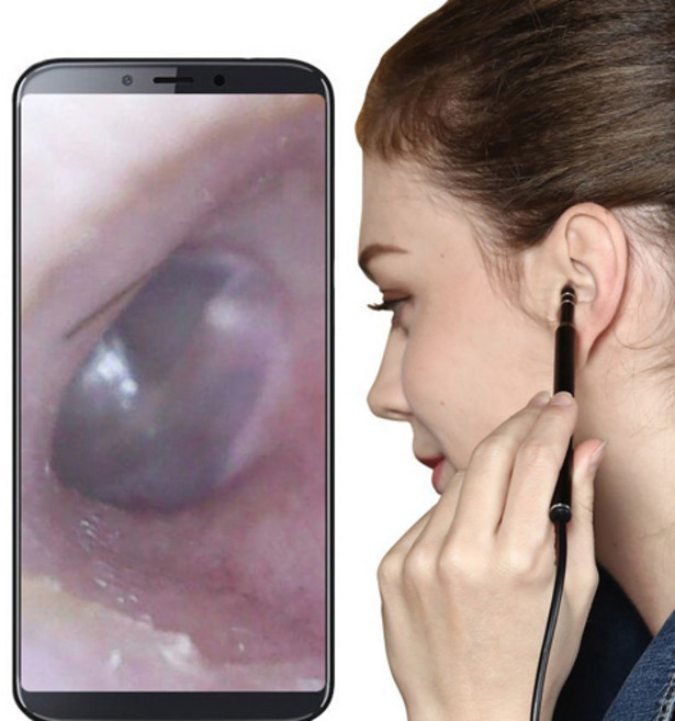 KC 인증 고화질 라이트 내시경 귀이개 스마트폰 안드로이드 PC, 1개, 블랙(안드로이드용)