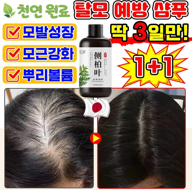 [천연식물추출] 탈모 예방 샴푸 비듬 약산성 지루성 두피 샴푸 두피 손상모 케어 관리 모근 강화 에센스 여성 남자 M자 탈모 완화 모발 성장 영양제, 2개, 300ml - 쿠팡