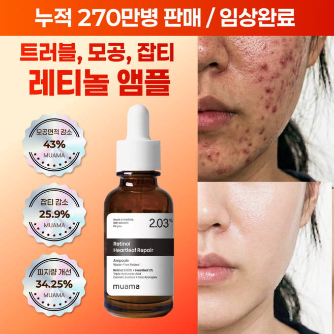 여드름성 피부 사용 적합 사춘기 트러블 진정 개선 모공감소 피지연화 5종 임상완료 [누적 270만병] 고함량 나이아신아마이드 레티놀 어성초 히알루론산 뮤아마 앰플 세럼, 1개, 30ml
