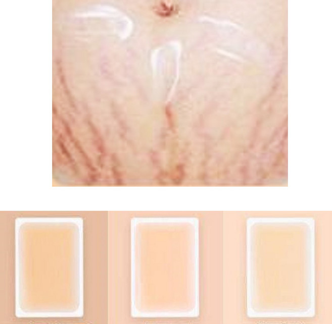 튼살커버 타투지우기 살색파스 백반증커버제 고체컨실러 멍커버, 1개, 1번