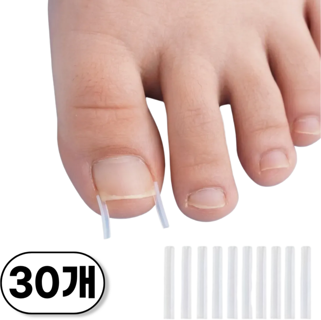 민지네 내성발톱 셀프 케어 스틱, 30개