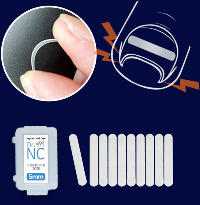 닥터엔씨 내성발톱 스트레치 팁 파고드는 발톱 용품, 5mmX10매, 1개