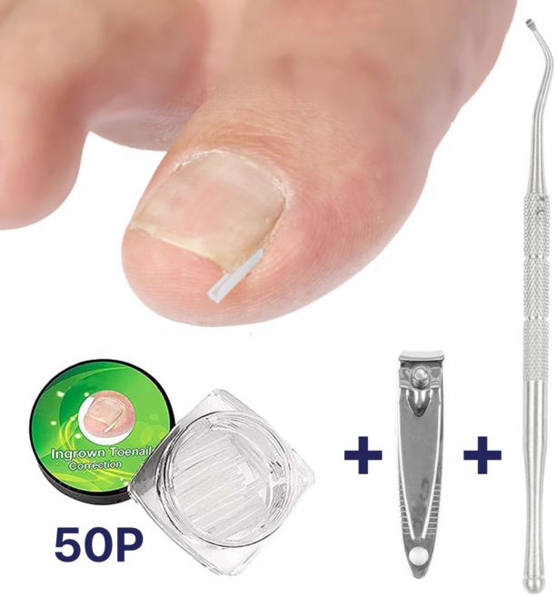 아르드 파고드는 발톱 도움 셀프 케어 관리 용품 세트, 1세트