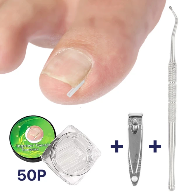 아르드 파고드는 발톱 도움 셀프 케어 관리 용품 세트, 1세트 - 쿠팡