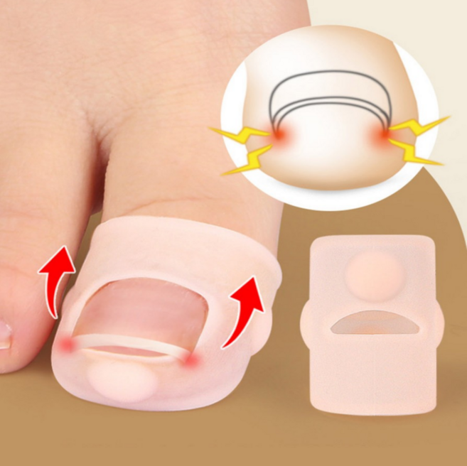 슈리팜 실리콘 내성발톱 방지 관리 커버, 4개