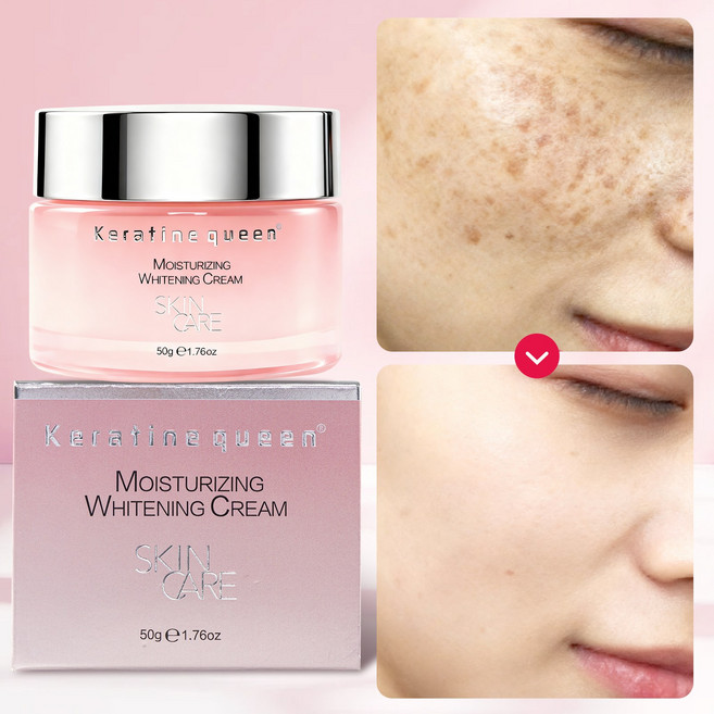 기미 잡티 제거 크림1위 | 기미 검버섯크림 1 위 검버섯 제거 크림1위미백 세럼 기미 잡티 제거 크림1위 니아신아마이드+알부틴 멜라토닝 크림 기미잡티크림 트라넥삼산 100% 크림, 1개, 50g