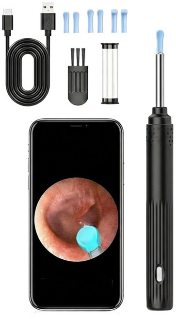 내시경 귀이개 스마트폰 LED 카메라 무선 와이파이 귀청소 USB 충전 아이폰 안드로이드 호환, 블랙, 1세트
