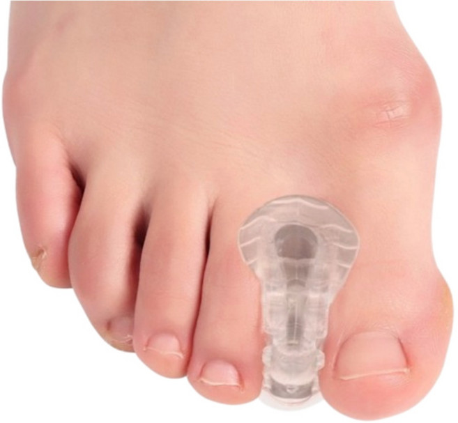 경이상점 엄지발가락 분리 실리콘 외출용 끼우개, 4개