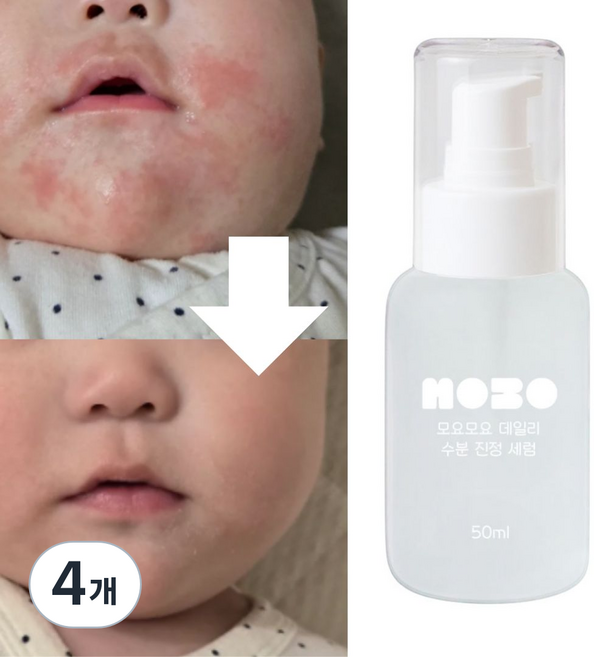 모요모요 침독크림 아기태열 초등학생앰플 고학년 사춘기 여드름화장품, 4개, 50ml