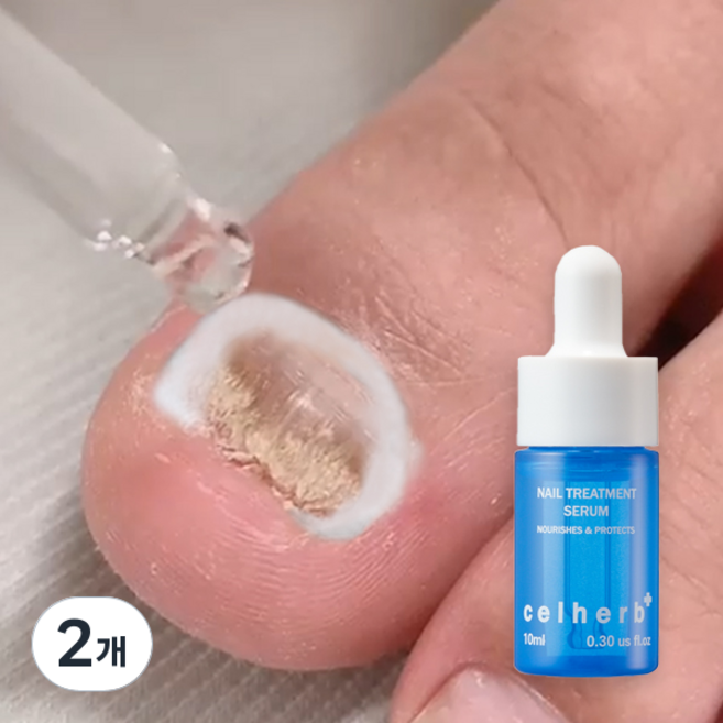 문제성 손발톱 전문케어 셀허브 리페어 세럼 손톱영양제 10ml, 2개