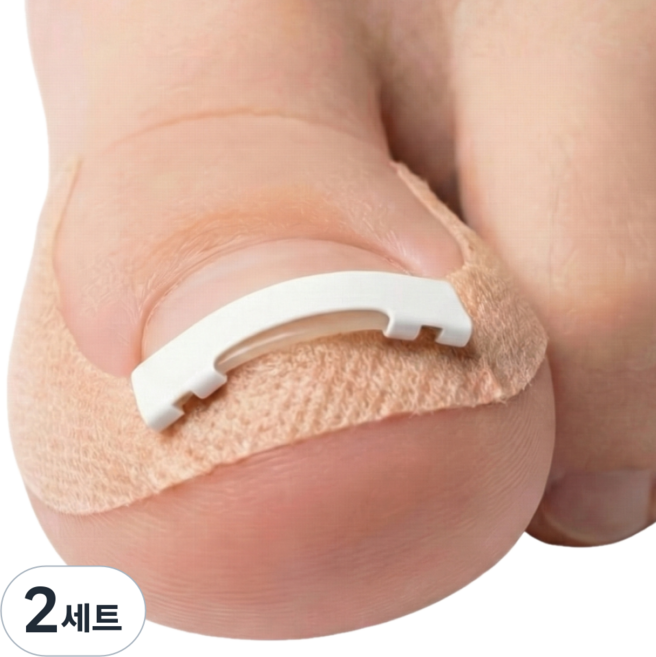 라이언문 니티놀 내성발톱 교정기, 2세트