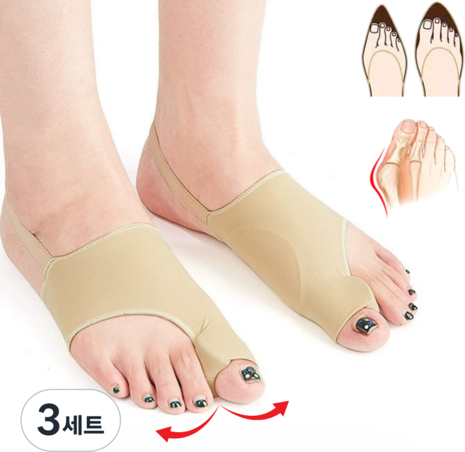 아노유 엄지발가락 분리 고정밴드 보호대 실리콘 밴드형 좌우 2개입, 3세트