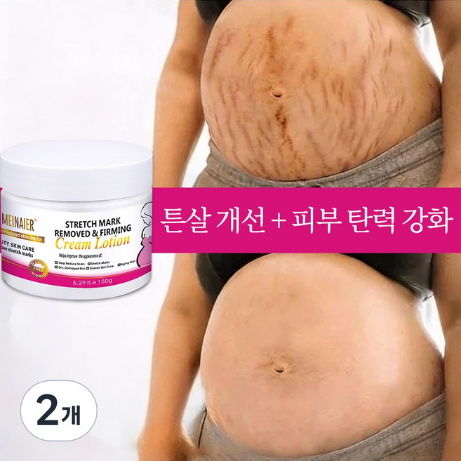 임신 크림 Stretch Mark Cream 임신부 바디 로션 산후 크림, 2개, 150g