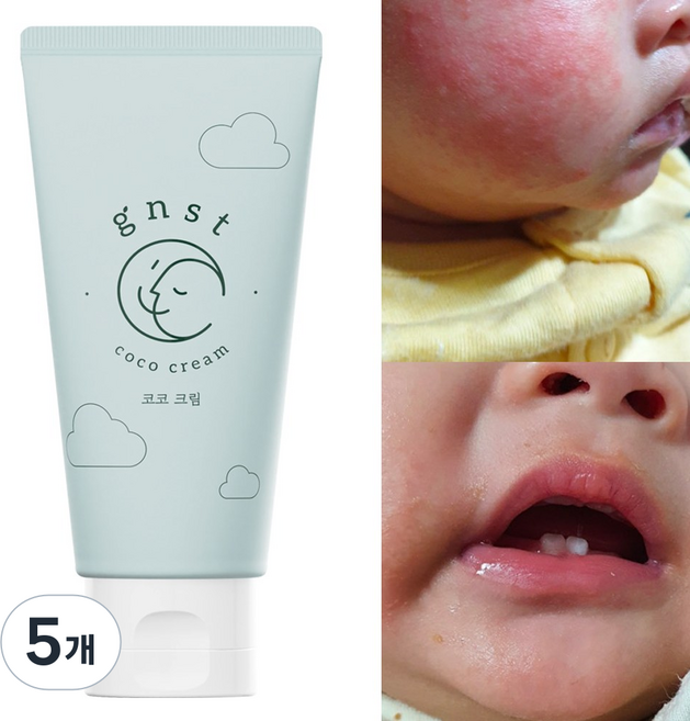 GNST 지엔에스티 코코 크림 침독크림 아기로션 유아로션 신생아, 80ml, 5개