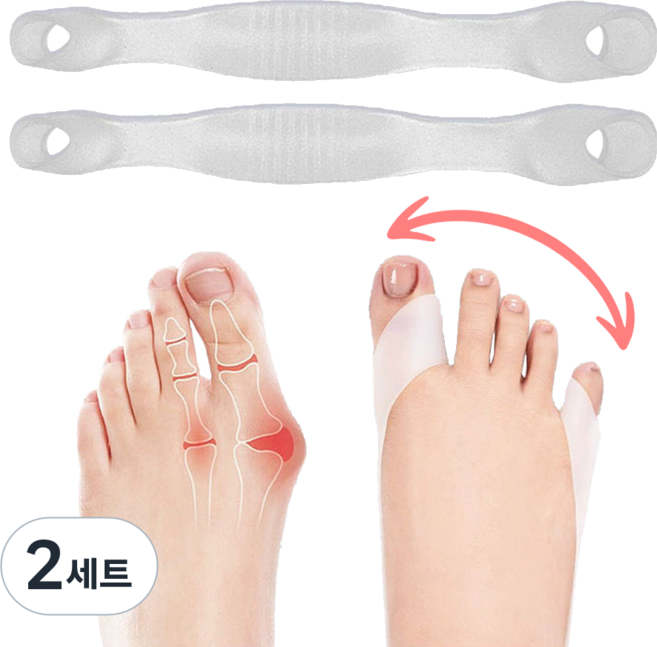 네버폴드 실리콘 무지외반증 발가락 교정기 초경량 외출겸용, 2세트
