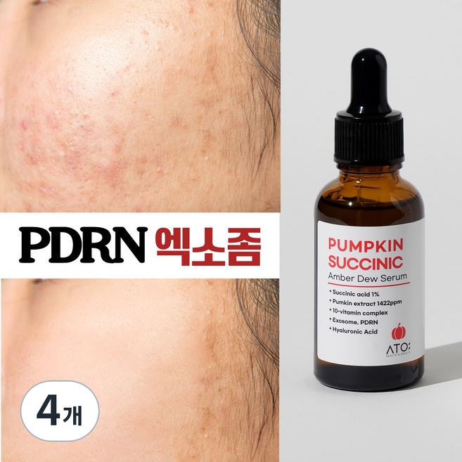 ATO 좁쌀여드름 결케어 피지케어 석시닉애씨드 1만 PPM PDRN 세럼, 4개, 30ml