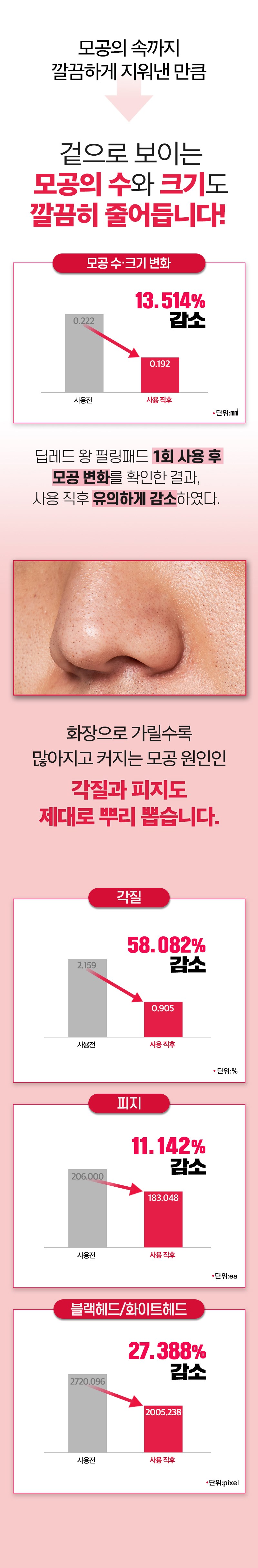 Polmediseun Deep Red Tea Tree Gakjil Care Large Size King Peeling Paedeu 170 ml, 70 Sheets Pack , 2 Pack (폴메디슨 딥레드 티트리 각질케어 대용량 왕필링패드 170ml, 70매입, 2개)