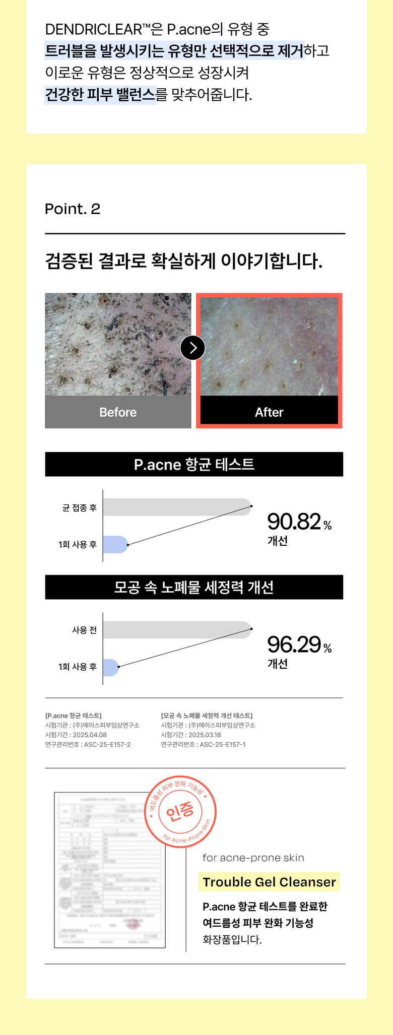 Selradikseu Trouble Clear Yaksanseong Gel Cleanser Acne Cleansing Akeuseugyun Scent Gyun , 1 Pack , 200 ml (셀라딕스 트러블 클리어 약산성 젤클렌저 여드름 클렌징 아크네스균 향균, 1개, 200ml)