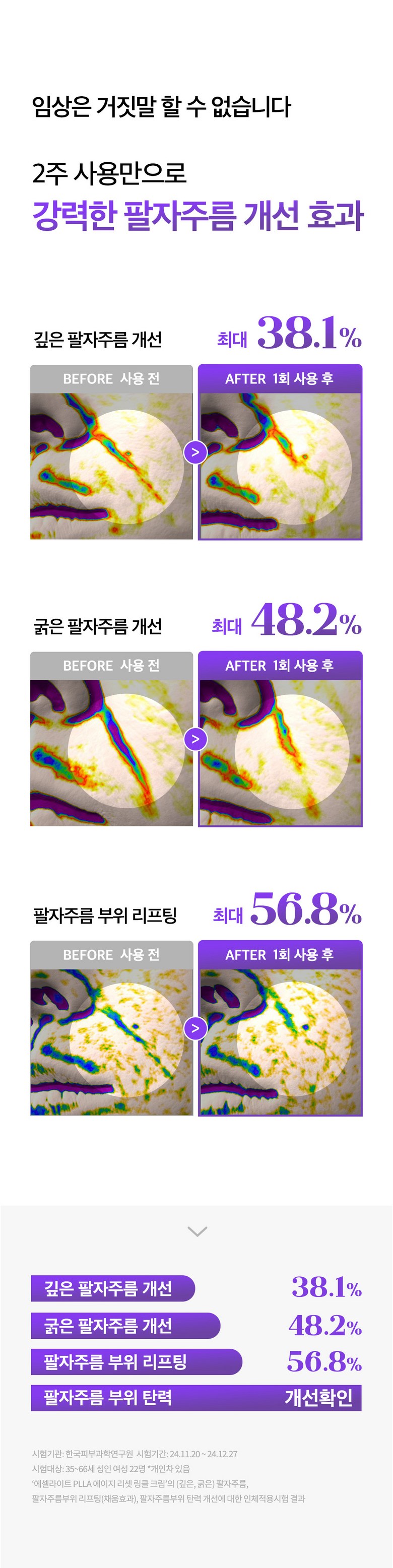 Paljapilreo Cream | Seul Selrateu PLLA Ji Riset Ringkeul Cream Peulreoseu , 1 Pack , 1 Pack (팔자필러크림 | 에슬 에셀라이트 PLLA 에이지 리셋 링클 크림 플러스, 1개, 1개입)