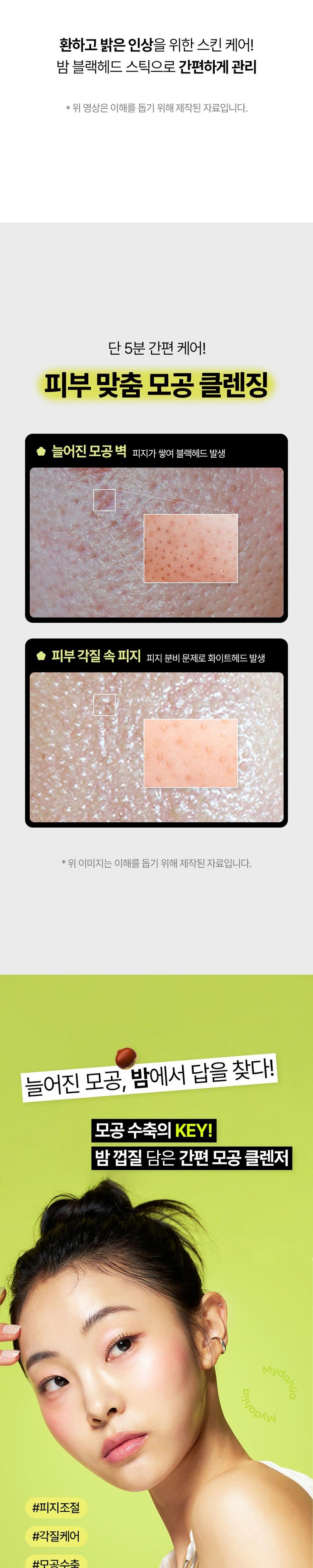 Madalria Bam Blackhead Stick 20 g, 1 Pack , 1 Pack (마이달리아 밤 블랙헤드 스틱 20g, 1개입, 1개)