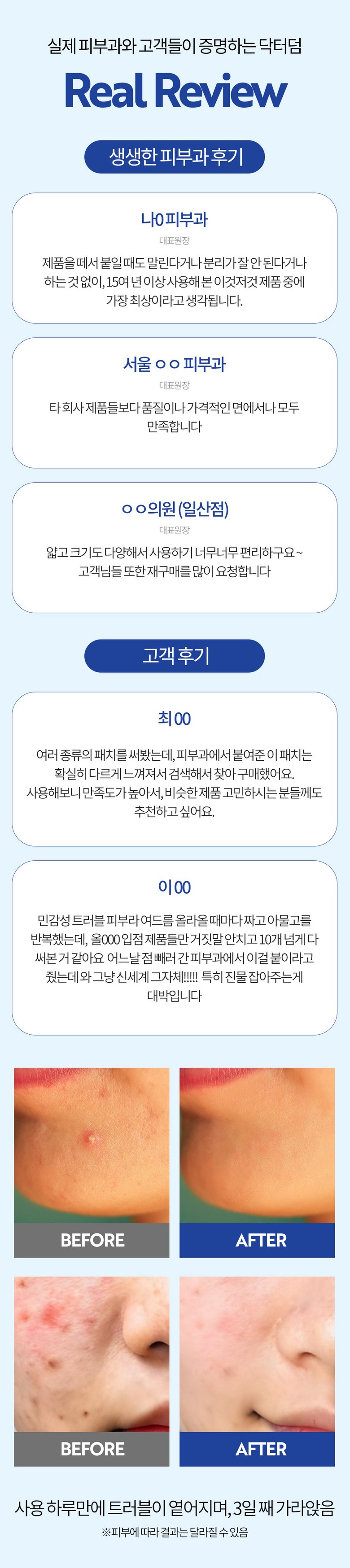 Dakteodeom Spot Paechi Acne Sangcheo Keobeopaechi Taek 1, 1 Pack , 15 2 Pack Pack (닥터덤 스팟패치 여드름 상처 커버패치 택 1, 1개, 152개입)