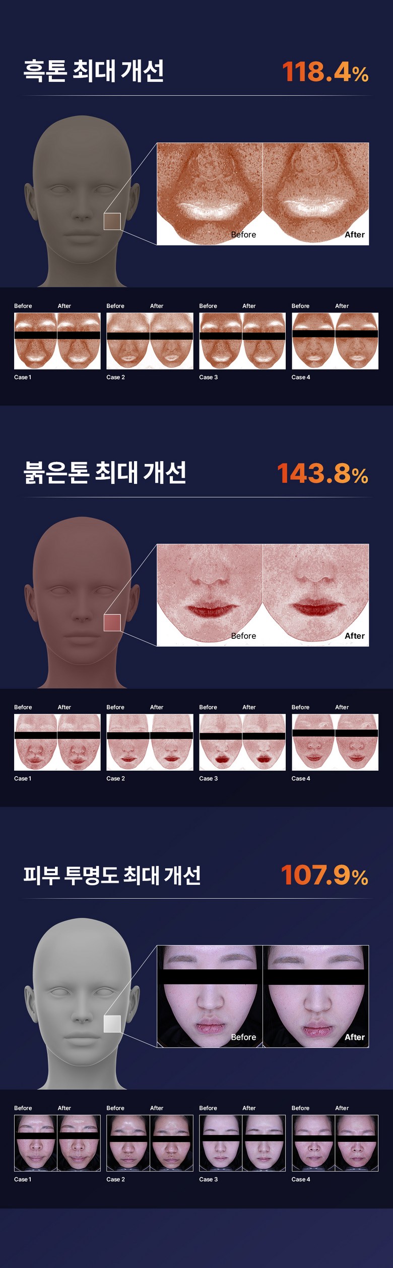 Mami Care Ossotamin Vitamin C Ampoule , 15 ml, 1 Pack (마미케어 오쏘타민 비타민C 앰플, 15ml, 1개)