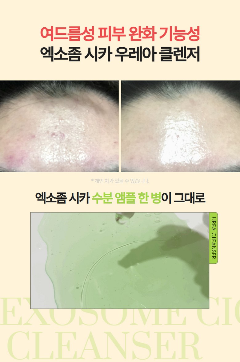 Eksojom Sika Moisture Gel Cleanser Yaksanseong Morning Acne Foam Cleansing , 1 Pack , 100 ml (엑소좀 시카 수분 젤 클렌저 약산성 아침 여드름 폼 클렌징, 1개, 100ml)