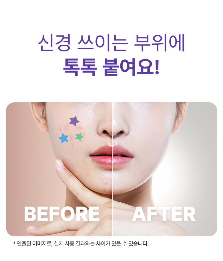 Beubiraep Byeol Moyang Akeu Acne Spot Care Paechi 6 Color Pack , 1 Pack , 240 Pack (브이비랩 별 모양 아크네 여드름 스팟 케어 패치 6컬러입, 1개, 240개입)