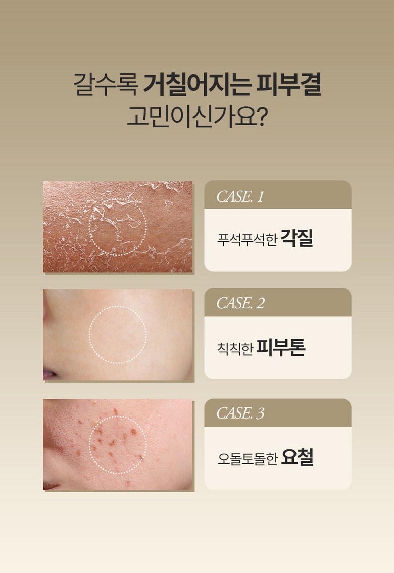 GMGN Reukoseu Chaltteok Beu Lightning Rice Gyeo Hyoso Powder Set Anje , 1 Pack , 50 g (GMGN 르코스 찰떡 브라이트닝 쌀겨 효소파우더 세안제, 1개, 50g)