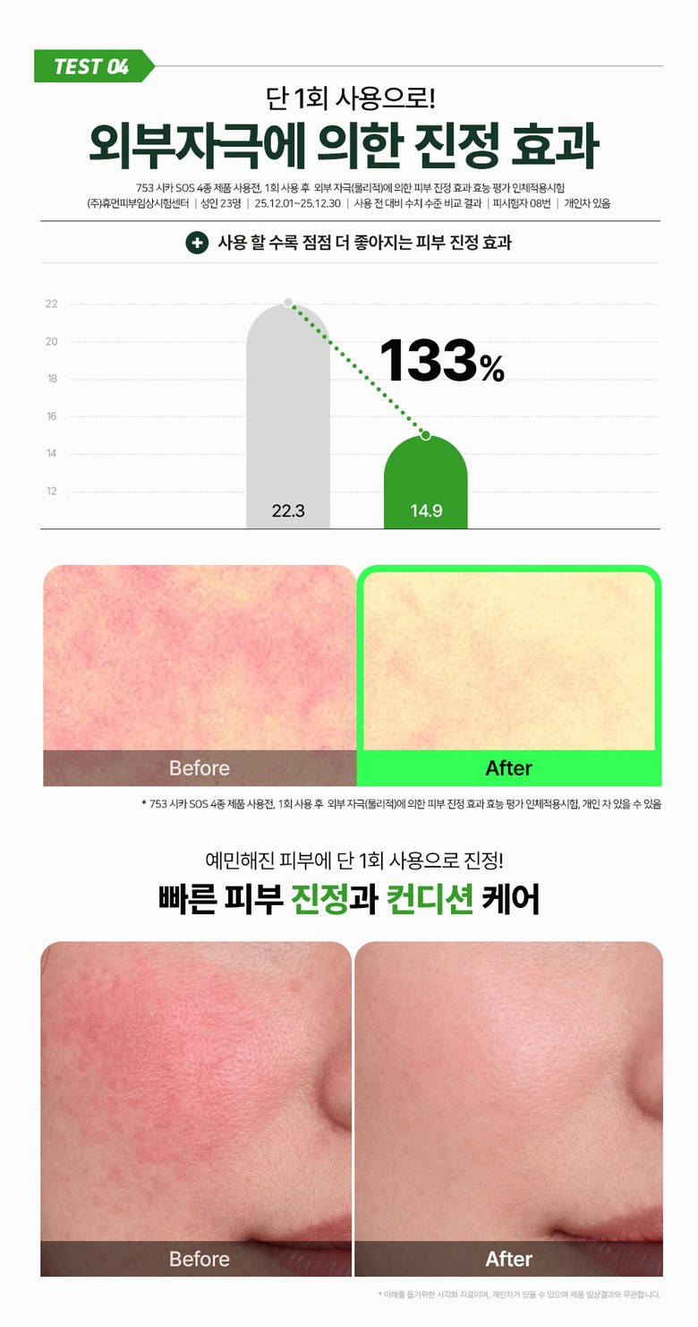 Dieogeulraem 753 Sika SOS Kaming Gel Cleanser , 2 Pack , 150 ml (디어글램 753 시카 SOS 카밍 젤 클렌저, 2개, 150ml)