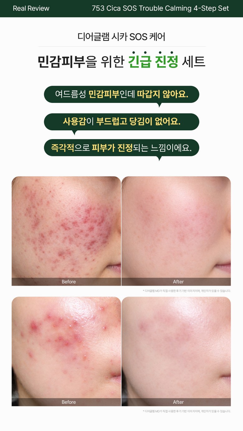 Dieogeulraem 753 Sika SOS Kaming Gel Cleanser , 2 Pack , 150 ml (디어글램 753 시카 SOS 카밍 젤 클렌저, 2개, 150ml)