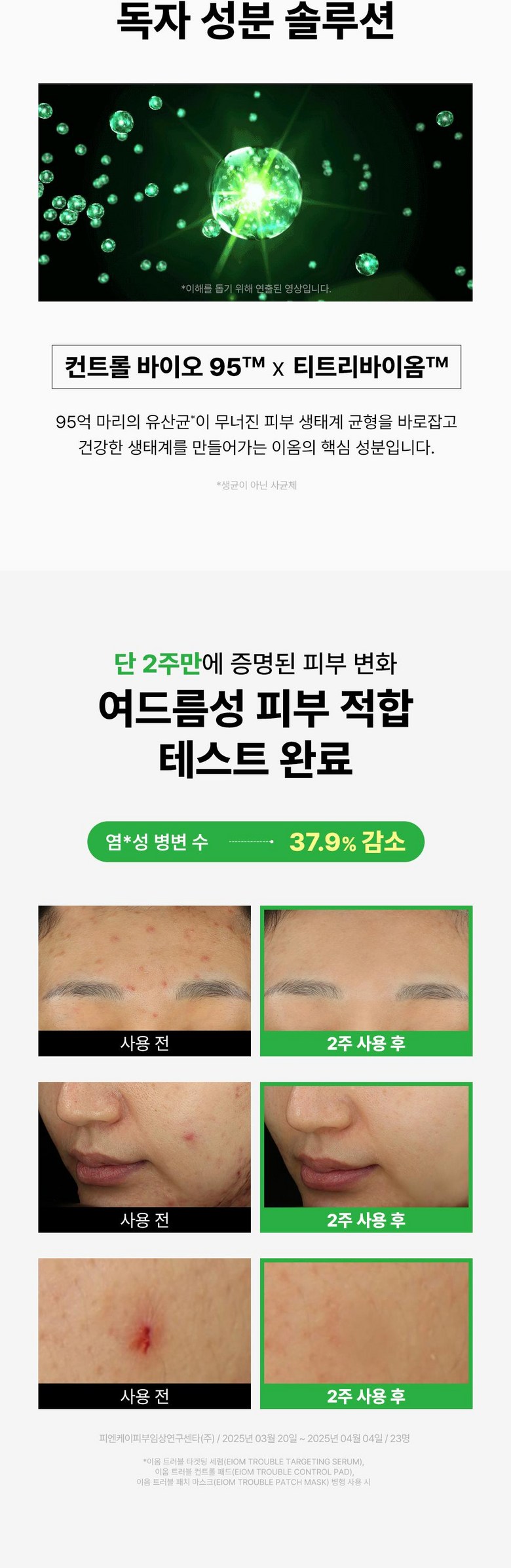 Om Trouble Paechi Mask , 1 Pack , 4 Pack Pack (이옴 트러블 패치 마스크, 1개, 4개입)