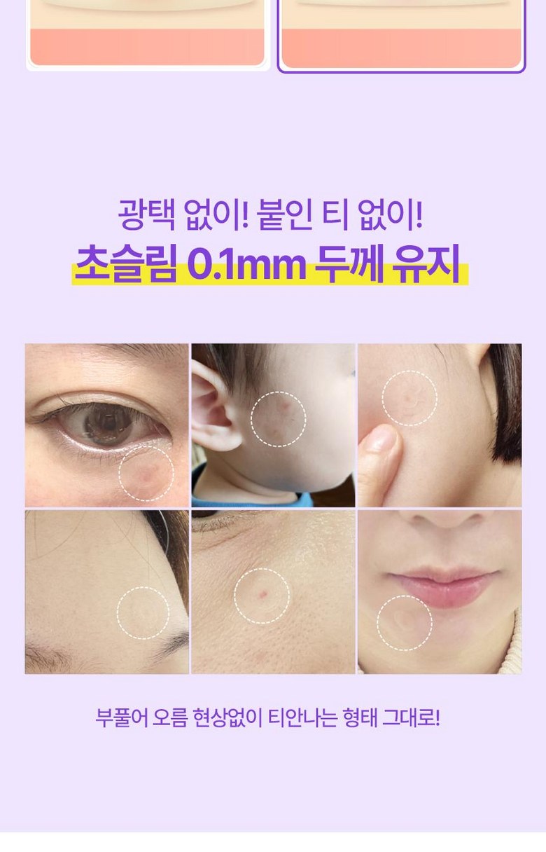 Selit Nanopaechi CELLOIT (11 mm) ECM Paechi Spot Paechi Spot Paechi Byuti , 1 Pack , 1 6 Pack (셀로잇 나노패치 CELLOIT (11mm) ECM패치 스팟패치 스팟 패치 뷰티, 1개, 16개입)