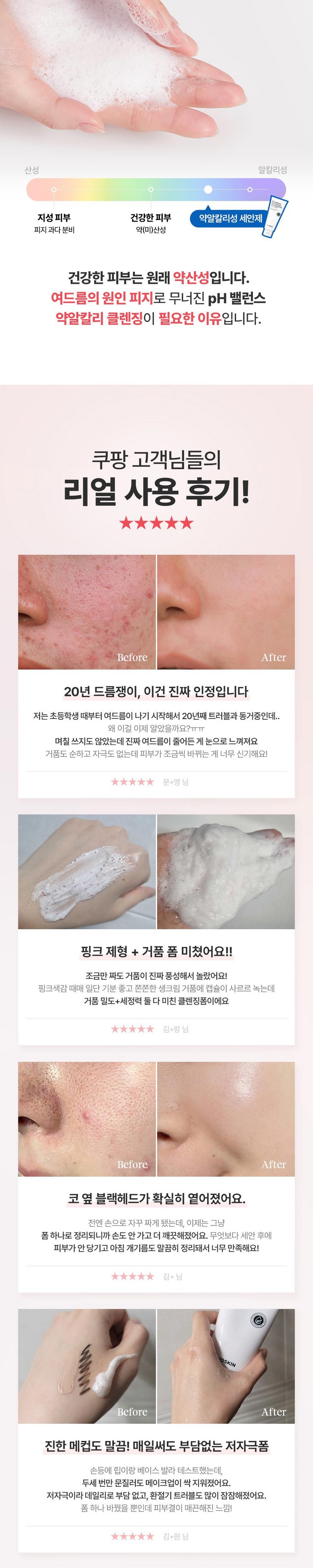 Sebum 92% Pack Seon Acne Wanhwa Cleansing Foam Pore Set Jeong Sikaeksojom Soothing Moisturizing Yakalkalri Low Irritation Blackhead Sebum Jegeo Nonkomejenik , 1 Pack , 120 (피지 92%개선 여드름완화 클렌징폼 모공세정 시카엑소좀 진정보습 약알칼리 저자극 블랙헤드 피지제거 논코메도제닉, 1개, 120ml)