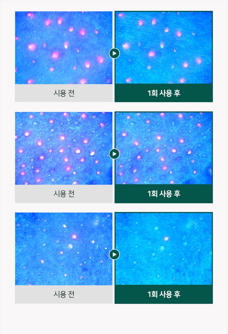Dadiri Sebum Noka Eoseongcho Woteo Ko Pack 80 ml Blackhead Sebum Yeonhwaje , 1 Pack , 1 Pack (다디리 피지녹아 어성초 워터 코팩 80ml 블랙헤드 피지연화제, 1개, 1개입)