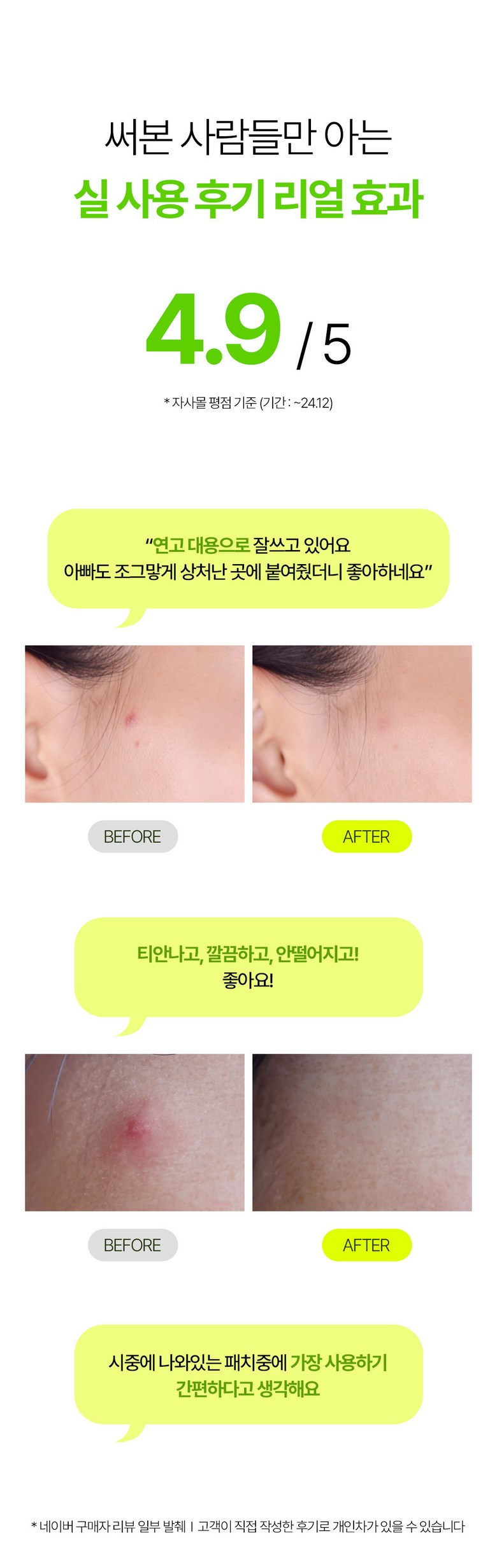 [189 Sheets ] Chogi Soothing / Soothing Acne Paechi Jaesaengtepeu Trouble Ppyoruji Spot Paechi Kaechimipaechi , 7 Pack , 27 Pack ([189매] 초기 진정/수딩 여드름패치 재생테이프 트러블 뾰루지 스팟패치 캐치미패치, 7개, 27개입)