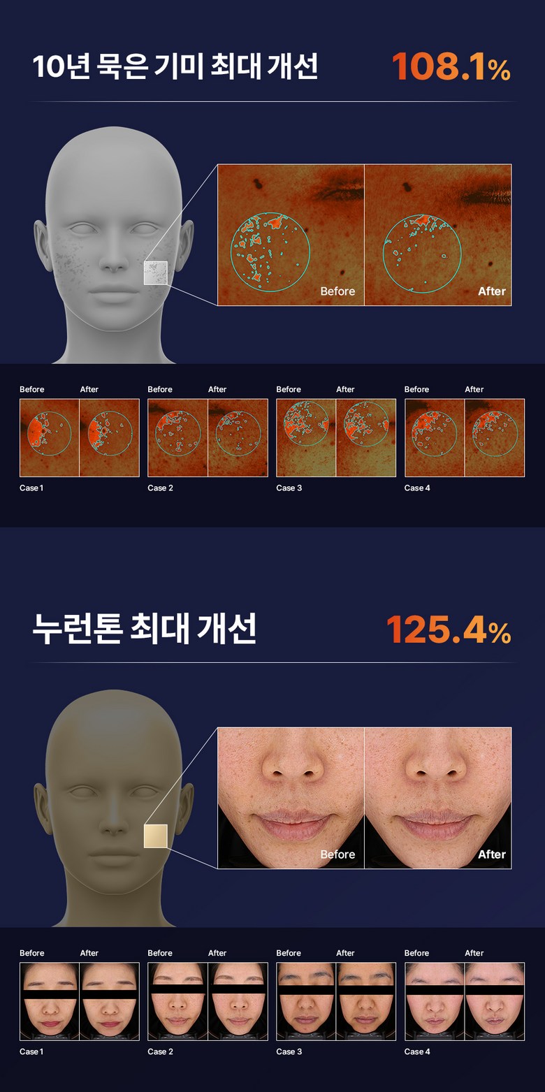 Mami Care Ossotamin Vitamin C Ampoule , 15 ml, 1 Pack (마미케어 오쏘타민 비타민C 앰플, 15ml, 1개)