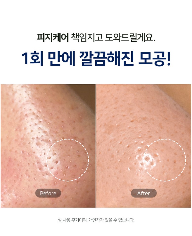 Dadiri Sebum Noka Eoseongcho Woteo Ko Pack 80 ml Blackhead Sebum Yeonhwaje , 1 Pack , 1 Pack (다디리 피지녹아 어성초 워터 코팩 80ml 블랙헤드 피지연화제, 1개, 1개입)