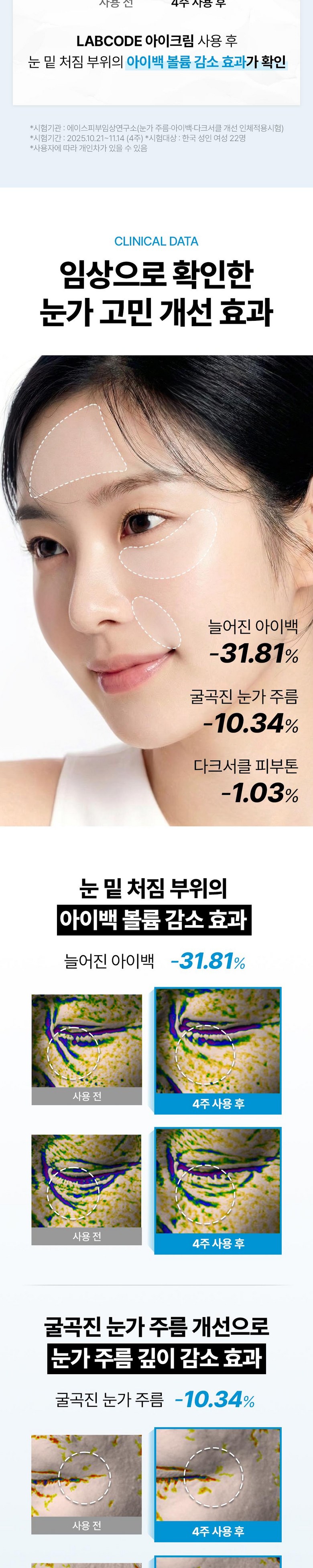 Raepkodeu PDRN Anti-Wrinkle Pack Seon Nunmit Jibangjegeo A Cream Abaek Dakeuseokeul Cream , 3 Pack , 30 ml (랩코드 PDRN 주름개선 눈밑 지방제거 아이크림 아이백 다크서클 크림, 3개, 30ml)
