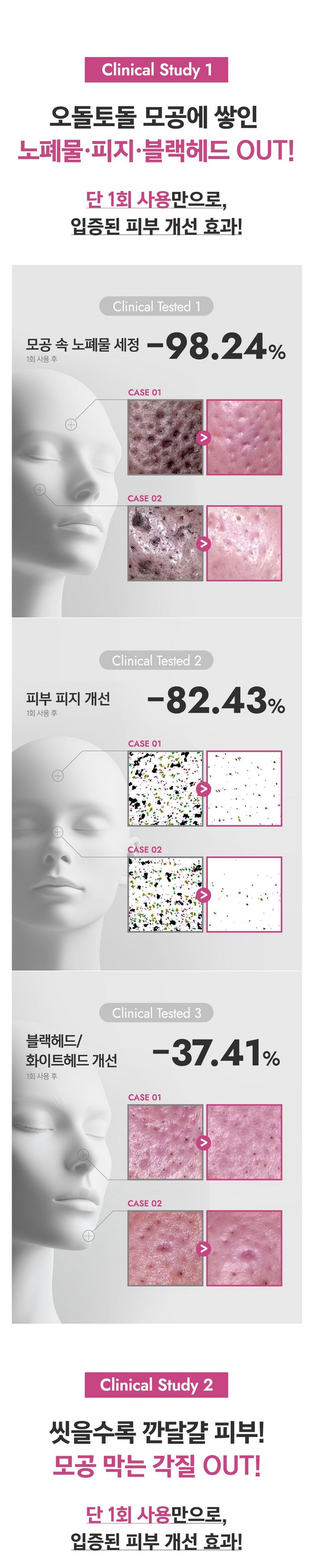 Terabikoseu Chakol Pore Sebum Deep Cleansing Foam Cleansing Blackhead Whitehead Sebum Heupchak Pore Cheongso Nopyemul Set Jeong Subuji Gakjil Care Yakalkalriseong (테라비코스 차콜 모공 피지 딥클렌징 폼 클렌징 블랙헤드 화이트헤드 피지흡착 모공청소 노폐물세정 수부지 각질케어 약알칼리성 피부진정 저자극 피지개선, 2개, 150m