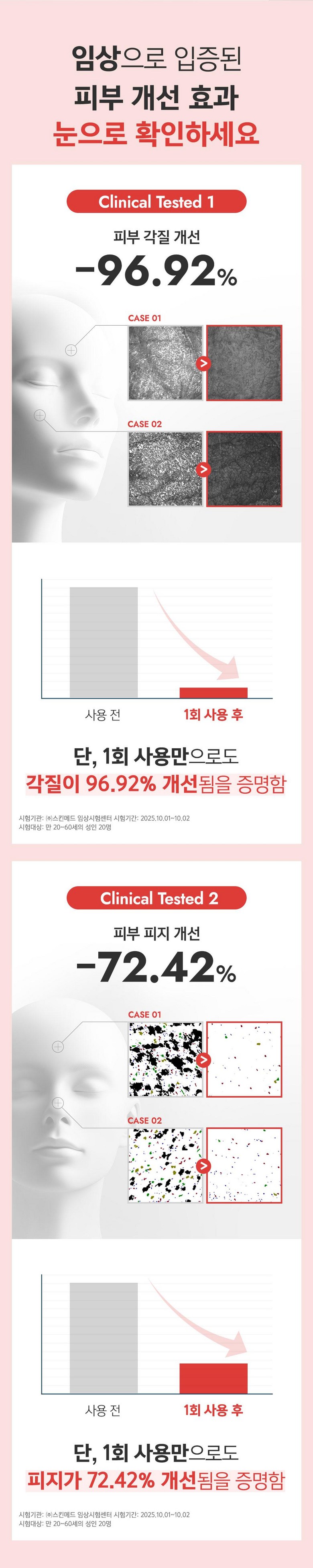 Terabikoseu Enjaim Acne Blemish Clear Foam Cleansing Trouble Jop Rice Acne Hwanongseong Acne Skin Gyeoljeongdon Soothing Pore Suryeom Yu Moisture Baelreo (테라비코스 엔자임 여드름 블레미쉬 클리어 폼 클렌징 트러블 좁쌀여드름 화농성여드름 피부결정돈 진정 모공수렴 유수분밸런스 각질케어 약알칼리성 살리실산 피부진정 저자극 피지개선, 2개