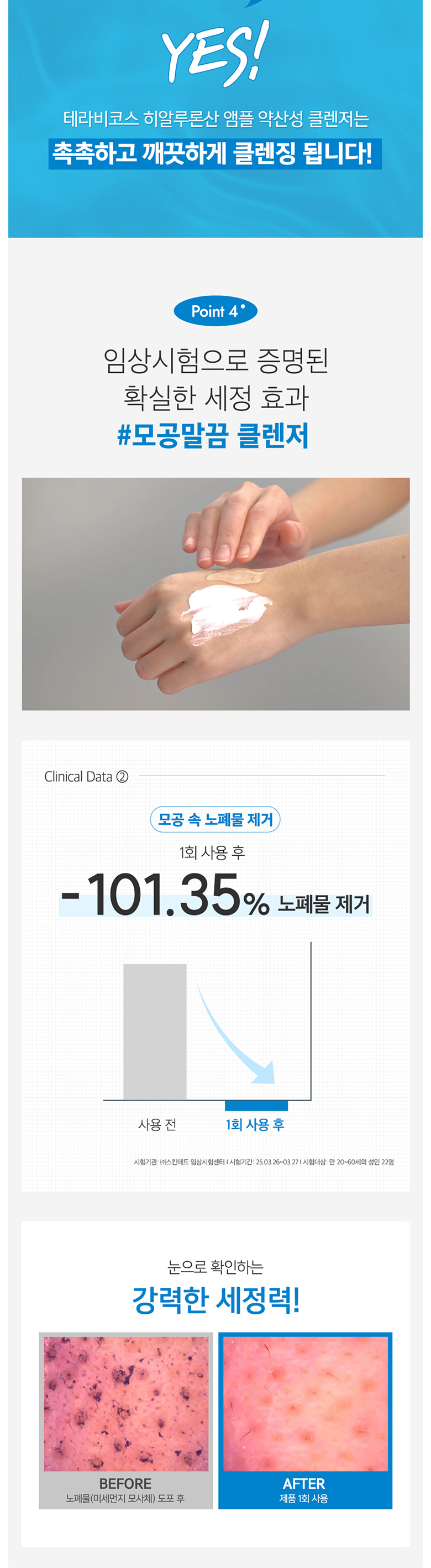 Terabikoseu Hyaluronic Acid Ampoule Yaksanseong Gel Cleanser Low Irritation Sensitive Soothing Nopyemul Set Jeong Morning Set Anje Mild Skin Moisturizing Pore Moisture , 1 Pack (테라비코스 히알루론산 앰플 약산성 젤 클렌저 저자극 민감 진정 노폐물세정 아침세안제 순한 피부보습 모공 수분, 1개, 150ml)