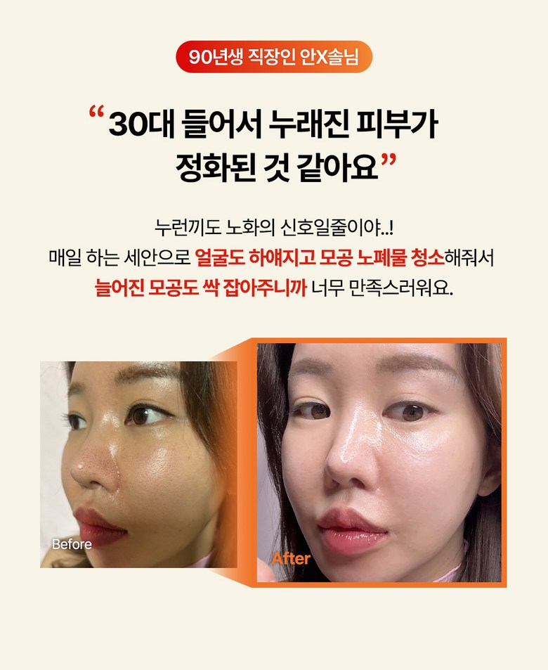 Mami Care 100 Sigan Sukseong Aesabi Cleanser Apple Toning Gwangchae Probiotics Pack Hangsanhwa Set An , 1 Pack , 190 ml (마미케어 100시간 숙성 애사비 클렌저 사과 토닝 광채 유산균 팩 항산화 세안, 1개, 190ml)
