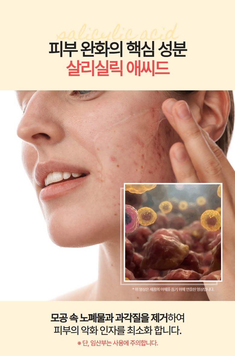 Eksojom Sika Moisture Gel Cleanser Yaksanseong Morning Acne Foam Cleansing , 1 Pack , 100 ml (엑소좀 시카 수분 젤 클렌저 약산성 아침 여드름 폼 클렌징, 1개, 100ml)