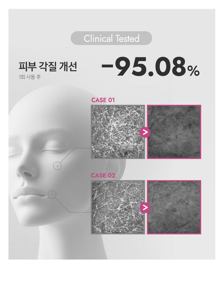 Terabikoseu Chakol Pore Sebum Deep Cleansing Foam Cleansing Blackhead Whitehead Sebum Heupchak Pore Cheongso Nopyemul Set Jeong Subuji Gakjil Care Yakalkalriseong (테라비코스 차콜 모공 피지 딥클렌징 폼 클렌징 블랙헤드 화이트헤드 피지흡착 모공청소 노폐물세정 수부지 각질케어 약알칼리성 피부진정 저자극 피지개선, 2개, 150m