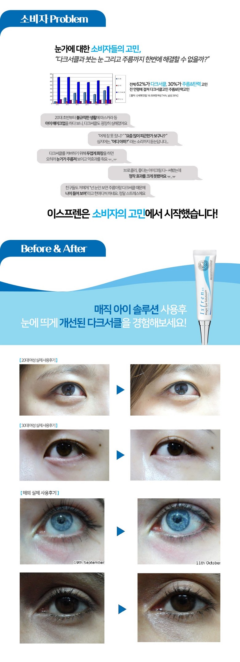 Seupeuren Magic A Solution Dakeuseokeul A Cream , 20 g, 1 Pack (이스프렌 매직아이솔루션 다크서클 아이크림, 20g, 1개)