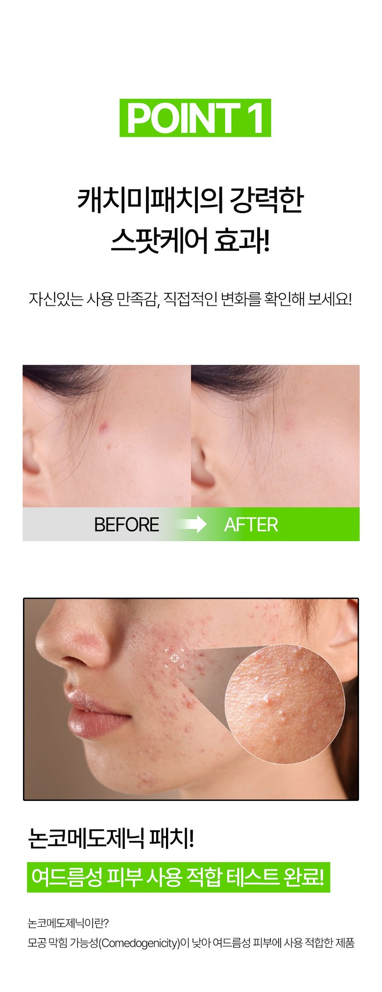[189 Sheets ] Chogi Soothing / Soothing Acne Paechi Jaesaengtepeu Trouble Ppyoruji Spot Paechi Kaechimipaechi , 7 Pack , 27 Pack ([189매] 초기 진정/수딩 여드름패치 재생테이프 트러블 뾰루지 스팟패치 캐치미패치, 7개, 27개입)