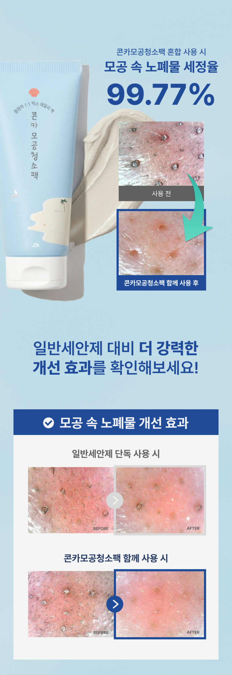 Joa Konka Pore Cheongso Pack Cleanser Seokeosseu 1 Bun Cleansing Pack , 1 Pack , 1 Pack (조아 콘카 모공청소팩 클렌저에 섞어쓰는 1분 클렌징팩, 1개, 1개입)
