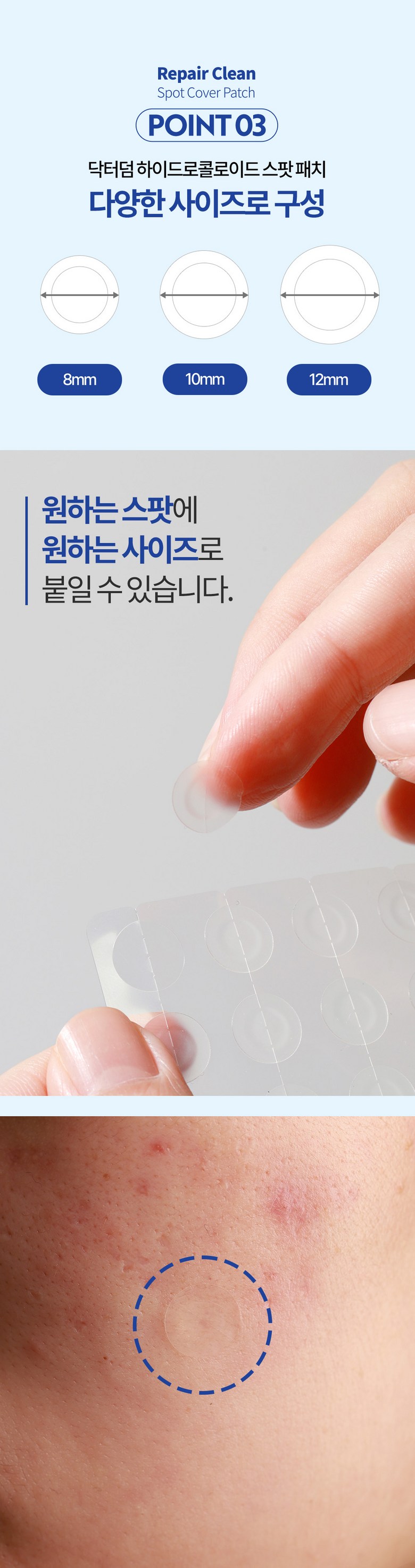 Dakteodeom Spot Paechi Acne Sangcheo Keobeopaechi Taek 1, 1 Pack , 15 2 Pack Pack (닥터덤 스팟패치 여드름 상처 커버패치 택 1, 1개, 152개입)